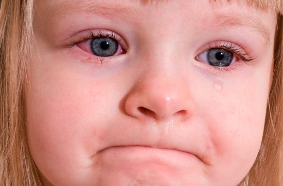 Докладно про алергічний нежить у дітей