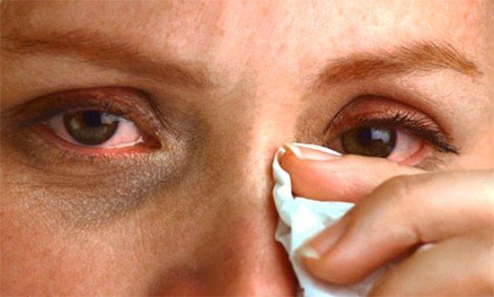 Ознаки алергічного нежитю