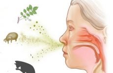 Як лікувати алергічний риніт