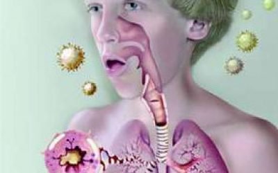 Ознаки бронхіальної астми