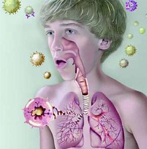Ознаки бронхіальної астми