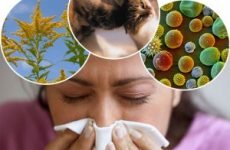 Алергічний синусит симптоми і лікування