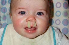 Зелені соплі у дитини, лікування за доктором Комаровським