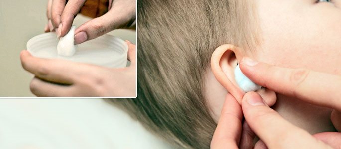 Варто заливати перекис водню у вуха при отиті та інших захворюваннях?