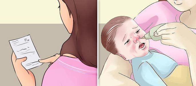 Сульфацил натрію (альбуцид) — краплі в ніс дитині