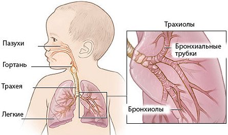 Пневмонія у дітей: причини, симптоми і лікування запалення легенів у дитини