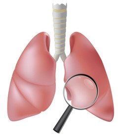 Тест: Як запідозрити туберкульоз легень?