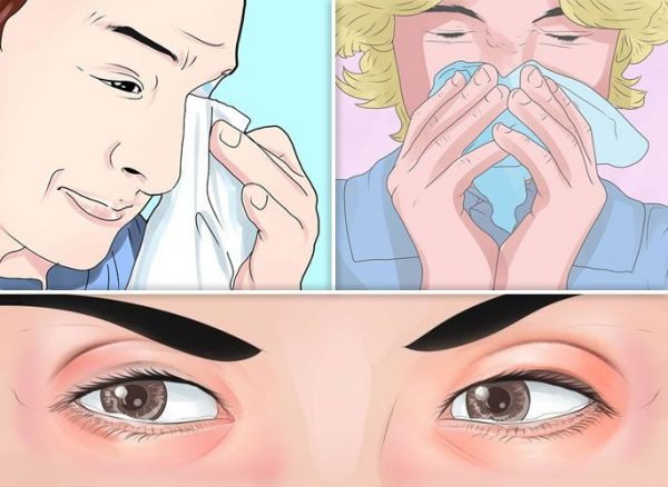 Алергічний синусит у дорослих і дітей: причини, симптоми, лікування