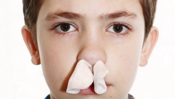 Причини крові з носа у дорослих та дітей, що робити
