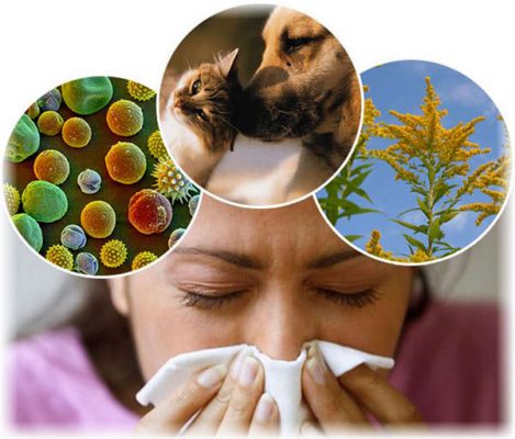 Алергічний риніт: лікування, симптоми, причини та ускладнення алергічного нежитю