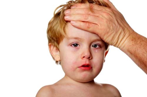 Синусит у дітей: ознаки і симптоми хвороби
