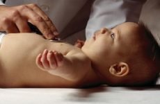 Ателектаз легені у новонародженого – 7 причин, симптоми та діагностика