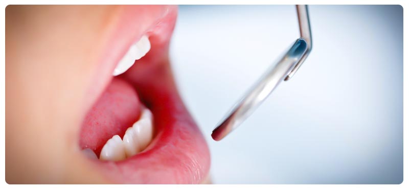 Що робити, якщо болять зуби при гаймориті   2 основні причини і лікування