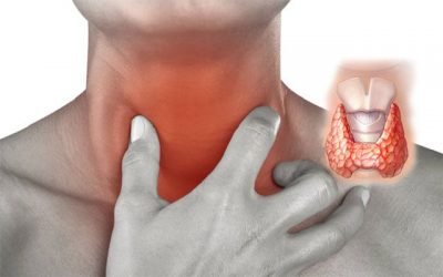 Тисне шию: причини і діагностика стиснення у горлі