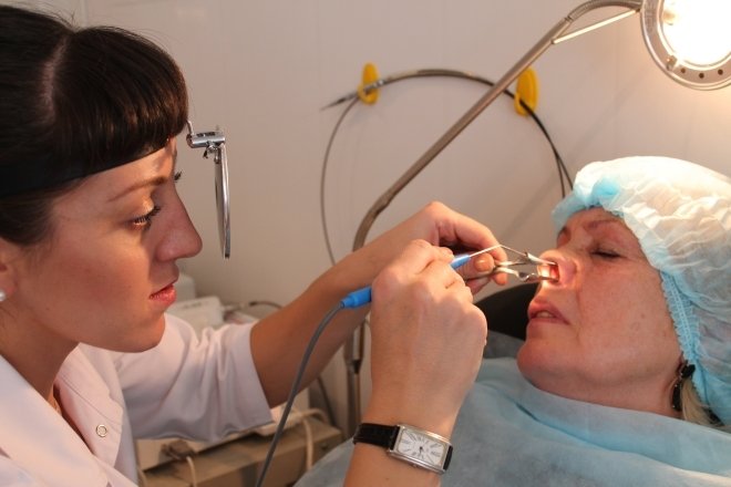 Ендоскопія пазух носа: опис і застосування методу