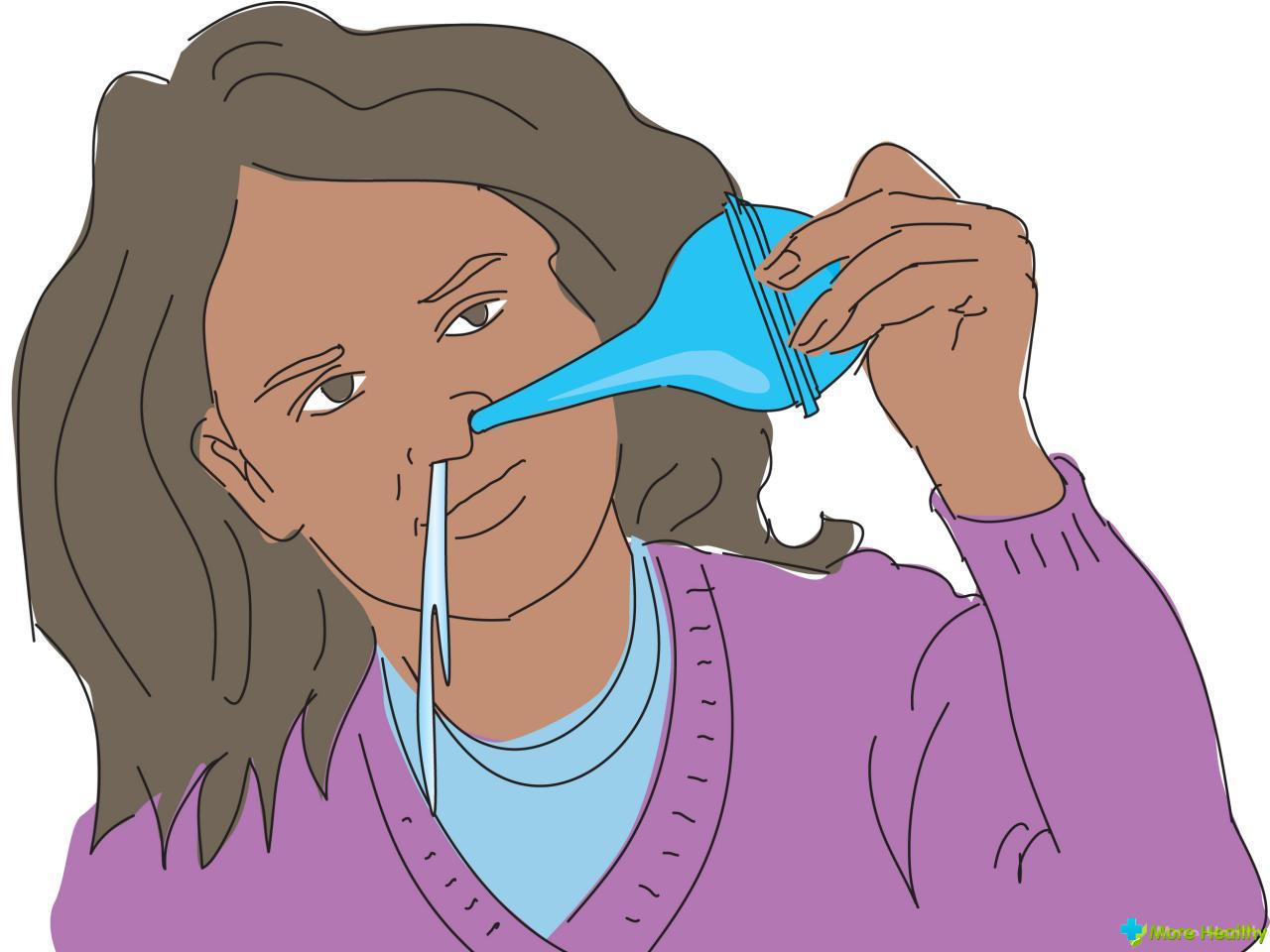 Правильное промывание носа в домашних условиях. Промывать нос. Полоскание носа. Промыть нос солевым раствором. Орошать нос.