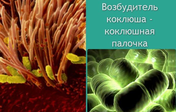 Мазок із зіву і носа на мікрофлору та чутливість до антибіотиків: розшифровка