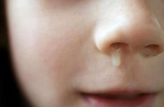 МРТ пазух носа: що показує і коли призначається?