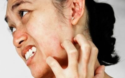 Нежить і закладеність носа на нервовому грунті: причини і лікування