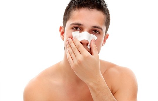 Перелом носа зі зміщенням і без: ознаки, симптоми і лікування