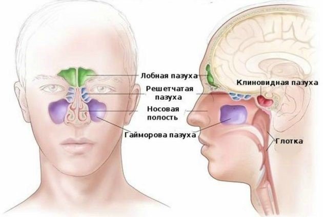 Риносинусит у дітей: симптоми і лікування, його форми – гострий гнійний