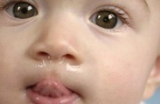 У дитини постійно соплі і закладений ніс: причини, що робити