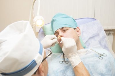 Видалення поліпів у носі: види операцій та вартість