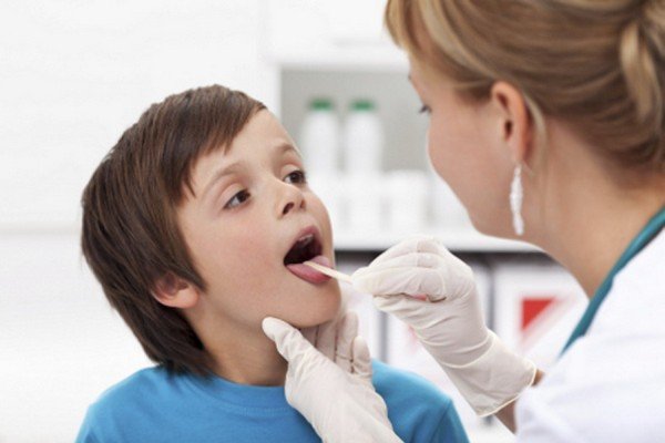 Запалення язичка в горлі: симптоми, причини та лікування в домашніх умовах