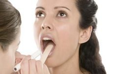 Білий наліт у горлі на мигдаликах – причини і лікування гланд
