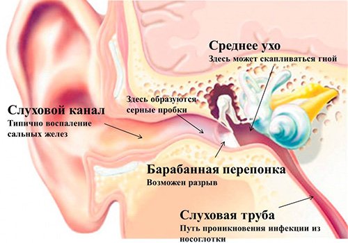 Біль у горлі і вусі: симптоматика, причини і лікування