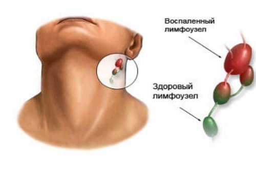 Біль за вухом: причини та можливі захворювання