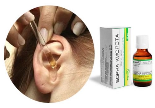 Борна кислота при лікуванні вуха: застосування і корисні властивості