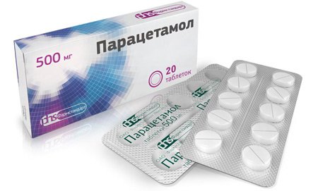 Гіпертрофічний фарингіт – симптоми і лікування у дорослих