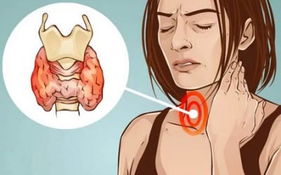 Гіпоплазія щитовидної залози – що це таке, симптоми та причини