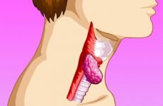 Симптоми раку горла та гортані – перші ознаки, стадії захворювання