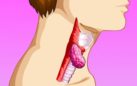 Симптоми раку горла та гортані – перші ознаки, стадії захворювання
