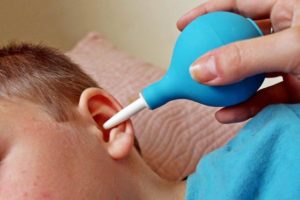 Способи і методи видалення сірчаної пробки з вуха