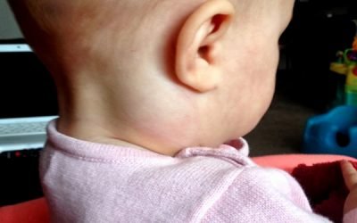 Збільшені лімфовузли на шиї у дитини: причини, симптоми і лікування