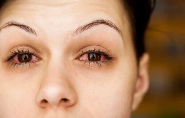 Чому з'являється біль в очах при застуді: офтальмологічні ускладнення при ГРЗ та їх лікування